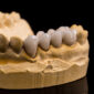 ceramic dentures 2023 11 27 05 22 07 utc 85x85