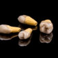 prosthetic teeth 2023 11 27 04 49 34 utc 85x85